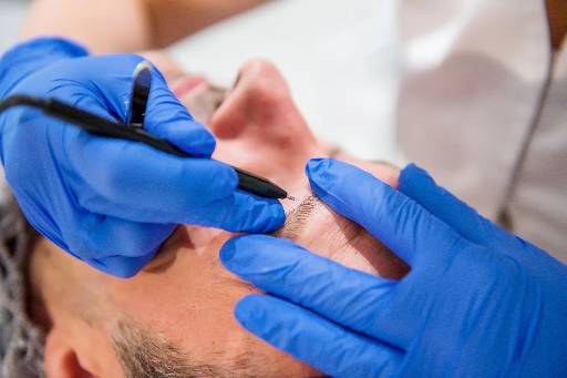 Cours de perfectionnement. #3  Pratique et Théorique  Electro-Epilation definitive